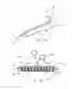 Fig. 08 - Device for rapid repair of body conduits