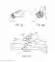Fig. 17 - Device for rapid repair of body conduits