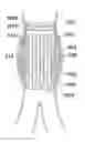 Fig. 01 - Endoprosthesis assemblies and methods to use the same