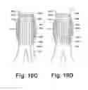 Fig. 20 - Endoprosthesis assemblies and methods to use the same
