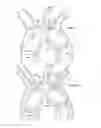 Fig. 06 - Branched stent graft device and deployment