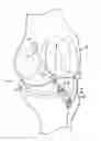 Fig. 01 - Ligament assembly