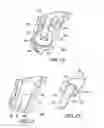 Fig. 11 - Ocular implant insertion apparatus and methods