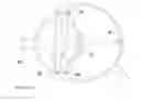 Fig. 11 - Intraocular Lens System