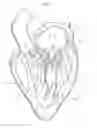 Fig. 03 - Heart valve prosthesis