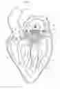 Fig. 05 - Heart valve prosthesis