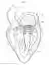 Fig. 06 - Heart valve prosthesis