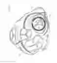 Fig. 10 - Heart valve prosthesis