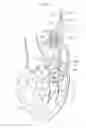 Fig. 13 - Heart valve prosthesis