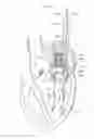 Fig. 15 - Heart valve prosthesis