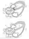 Fig. 02 - SELF-ASSEMBLING PERCUTANEOUSLY IMPLANTABLE HEART VALVE