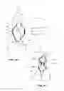 Fig. 08 - Method and apparatus useful for transcatheter aortic valve implantation