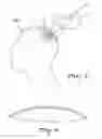 Fig. 04 - ULTRASOUND-COMPATIBLE ARTIFICIAL CRANIAL OPERCULUM