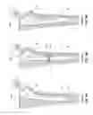 Fig. 07 - INTRINSIC STABILITY IN A TOTAL HIP STEM