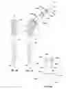 Fig. 12 - INTRINSIC STABILITY IN A TOTAL HIP STEM