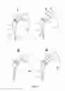 Fig. 03 - Adjustable modular spacer device for the articulations of the human body