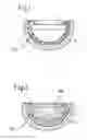 Fig. 02 - POLYLOCK INSERT FOR AN ARTIFICIAL HIP JOINT