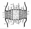 Fig. 01 - Method for relieving back/neck pain and repairing intervertebral disc