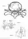 Fig. 06 - Method for relieving back/neck pain and repairing intervertebral disc