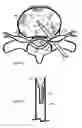Fig. 09 - Method for relieving back/neck pain and repairing intervertebral disc