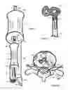 Fig. 12 - Method for relieving back/neck pain and repairing intervertebral disc