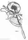 Fig. 16 - Method for relieving back/neck pain and repairing intervertebral disc