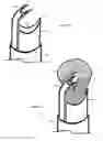 Fig. 30 - Method for relieving back/neck pain and repairing intervertebral disc