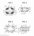 Fig. 02 - Intervertebral implant