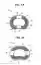 Fig. 03 - Intervertebral implant