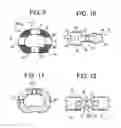 Fig. 05 - Intervertebral implant