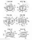 Fig. 16 - Intervertebral implant