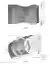 Fig. 03 - INTRALUMINAL IMPLANTS AND METHODS