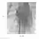 Fig. 05 - INTRALUMINAL IMPLANTS AND METHODS