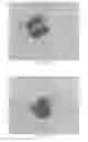 Fig. 21 - INTRALUMINAL IMPLANTS AND METHODS