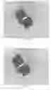 Fig. 25 - INTRALUMINAL IMPLANTS AND METHODS