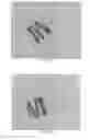 Fig. 26 - INTRALUMINAL IMPLANTS AND METHODS