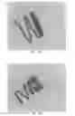 Fig. 27 - INTRALUMINAL IMPLANTS AND METHODS