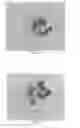 Fig. 31 - INTRALUMINAL IMPLANTS AND METHODS