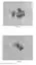 Fig. 32 - INTRALUMINAL IMPLANTS AND METHODS