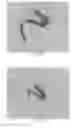 Fig. 35 - INTRALUMINAL IMPLANTS AND METHODS