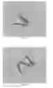 Fig. 36 - INTRALUMINAL IMPLANTS AND METHODS