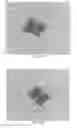 Fig. 40 - INTRALUMINAL IMPLANTS AND METHODS