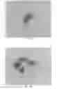 Fig. 42 - INTRALUMINAL IMPLANTS AND METHODS