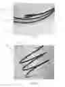 Fig. 45 - INTRALUMINAL IMPLANTS AND METHODS