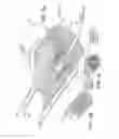 Fig. 03 - Systems and methods for magnetized stent having growth-promoting properties