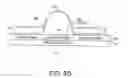 Fig. 04 - Systems and methods for magnetized stent having growth-promoting properties