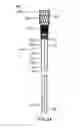 Fig. 06 - Devices and methods for gastrointestinal bypass