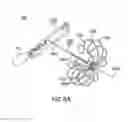 Fig. 10 - Devices and methods for gastrointestinal bypass