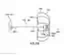 Fig. 11 - Devices and methods for gastrointestinal bypass