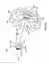 Fig. 13 - Devices and methods for gastrointestinal bypass